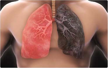 Respiratory Meaning in Gandhinagar
